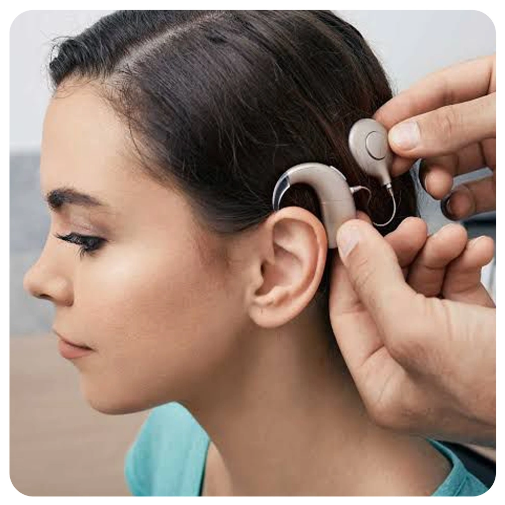 cochlear implant